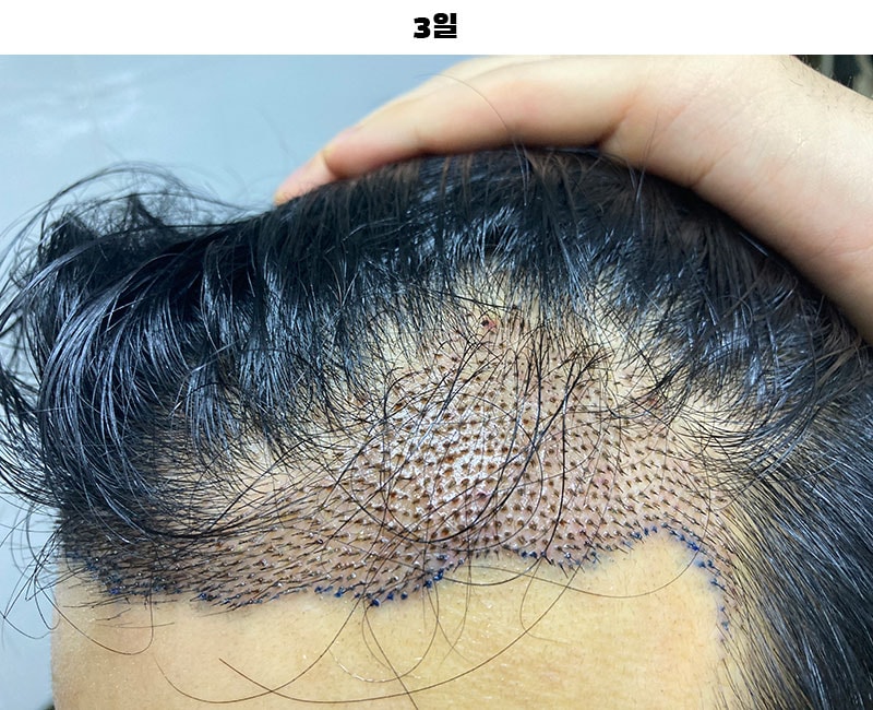 3개월 기록용
