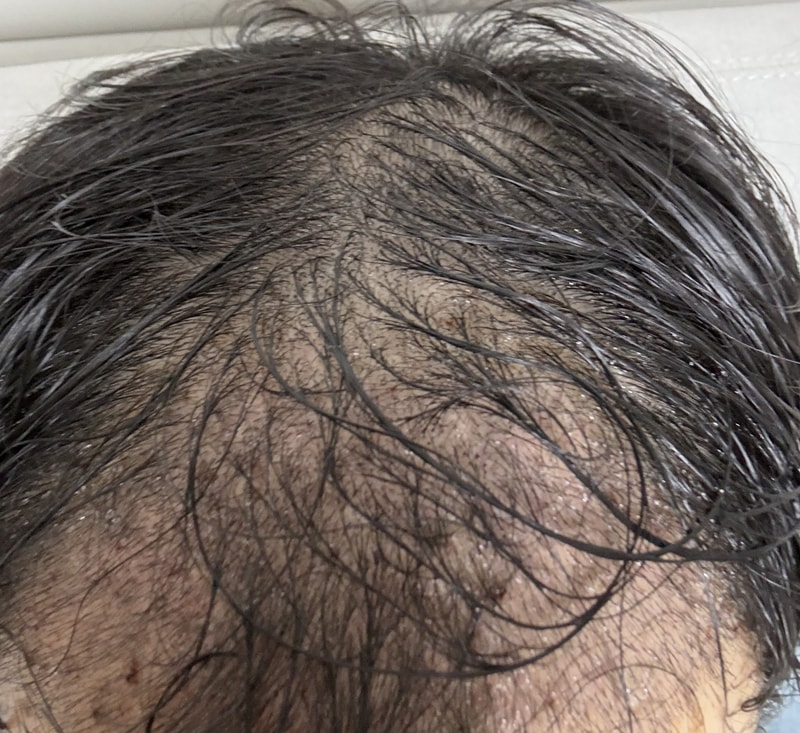 狎鴎亭 毛羽林クリニック手術体験談