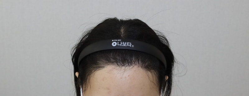 6개월 1.jpg