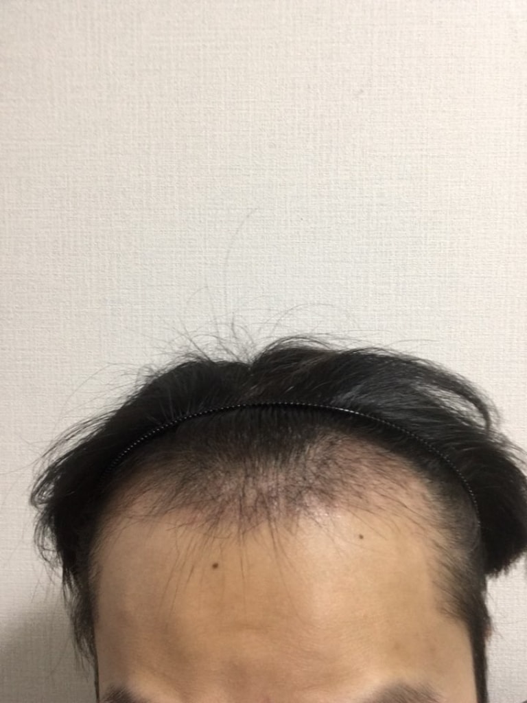 9월11일(1달3).jpg