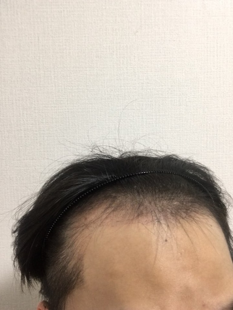 9월11일(1달).jpg