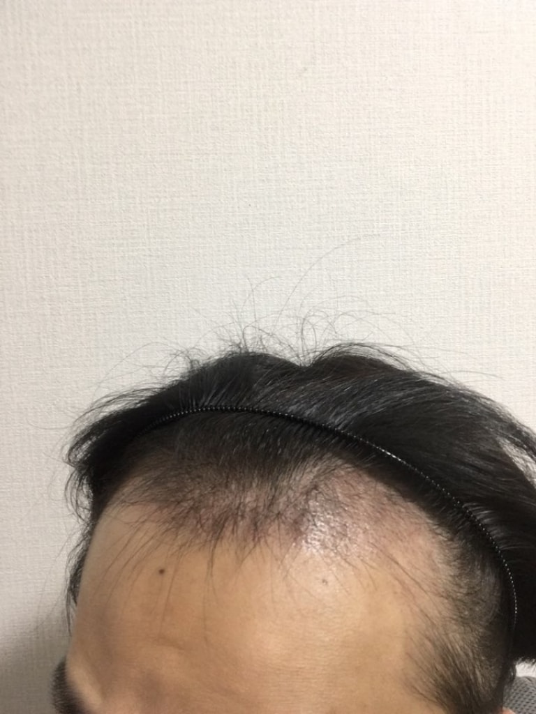 9월11일(1달2).jpg