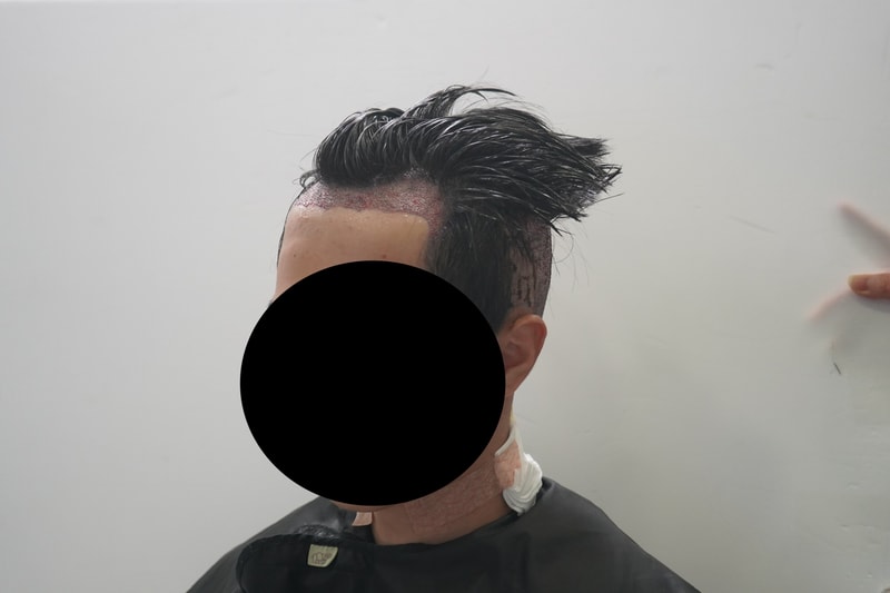 수술직후 1.JPG