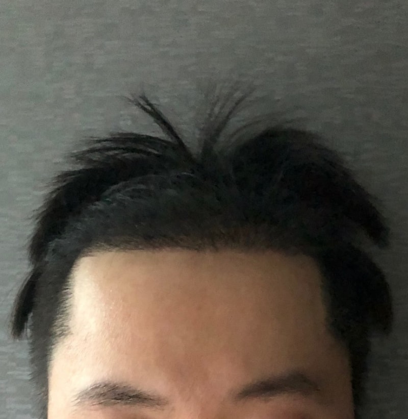 후.jpg