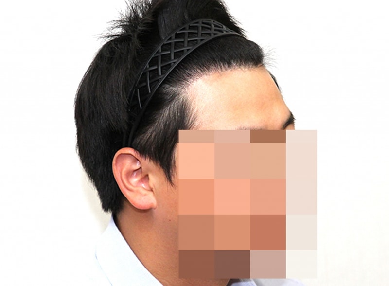 후2.jpg