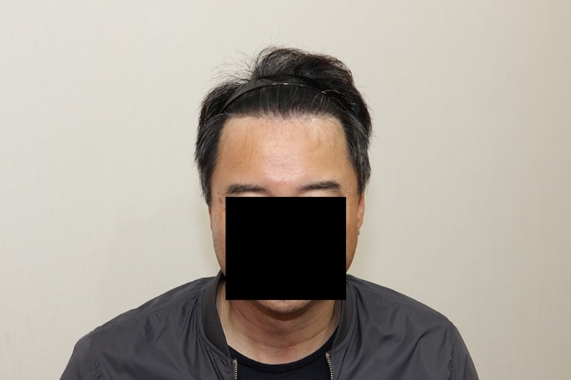후1.JPG