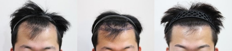 기본.jpg