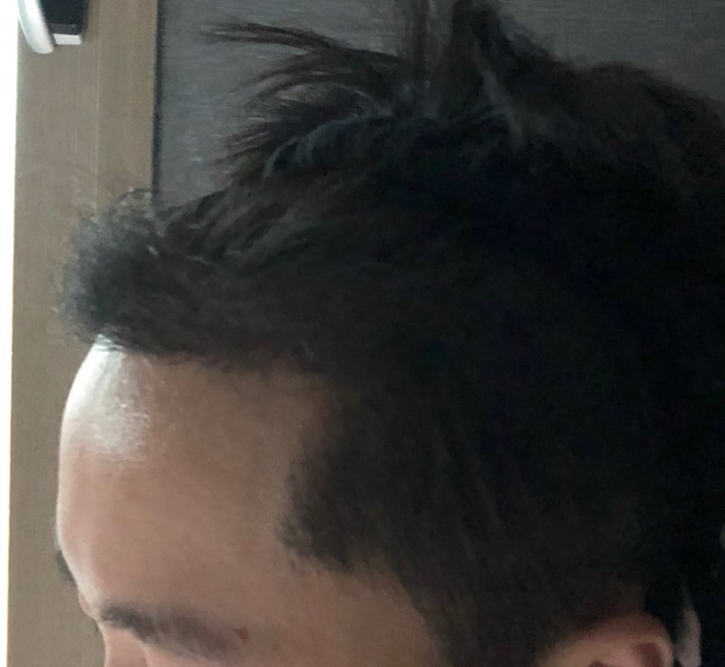 후2.jpg
