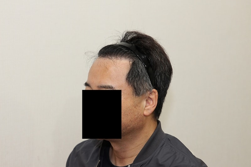 후2.JPG
