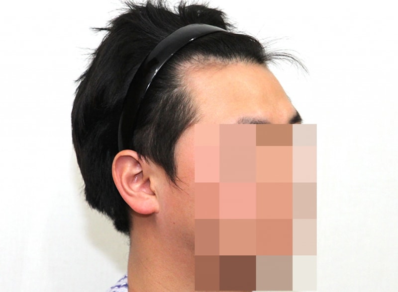 전2.jpg