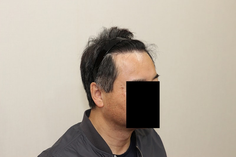 후3.JPG
