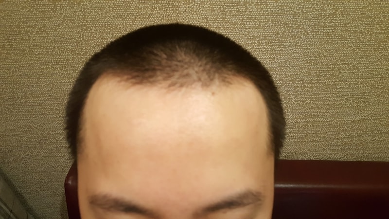 전1.jpg