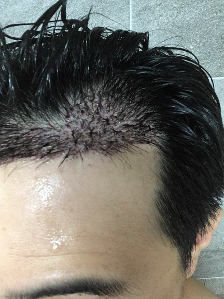 KakaoTalk_20180803_102556395.png
