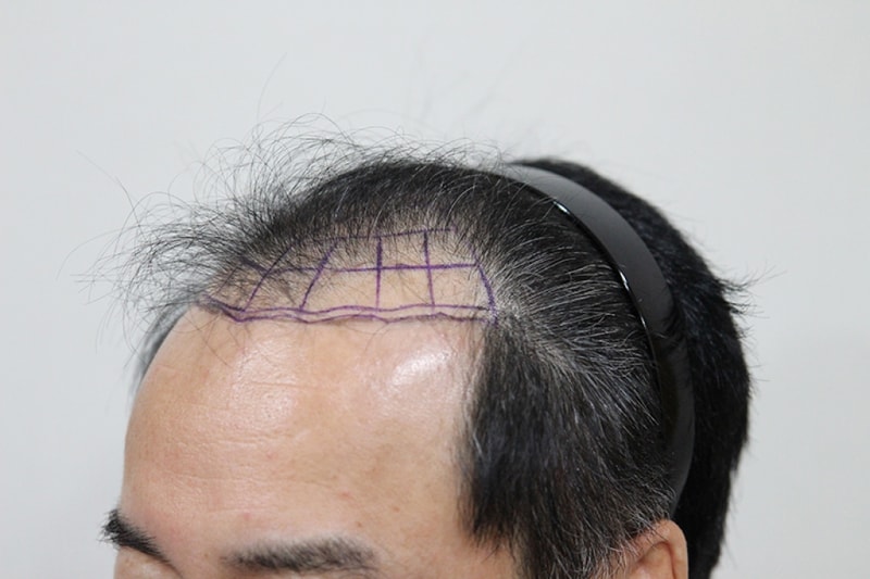 전2.JPG