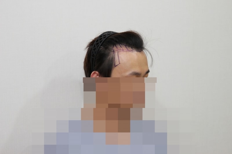 전 (1).JPG