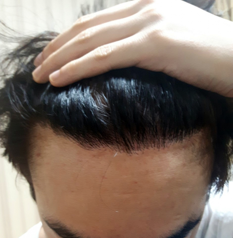 셀카7.png