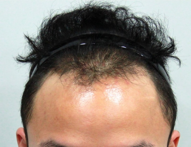캡처1.JPG