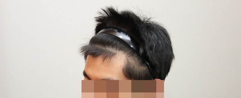 후2.jpg