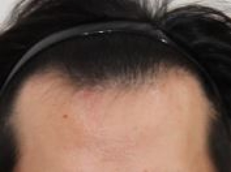 전.JPG