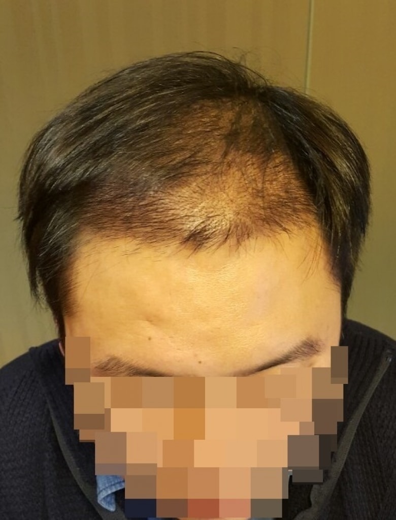 수술후4.jpg