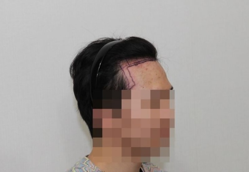 수술전3.JPG