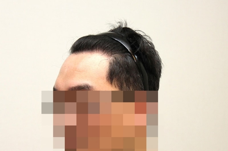 후3.jpg