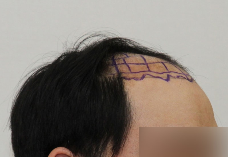BEFORE.JPG