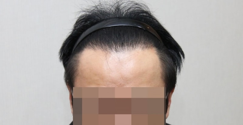 후1.jpg