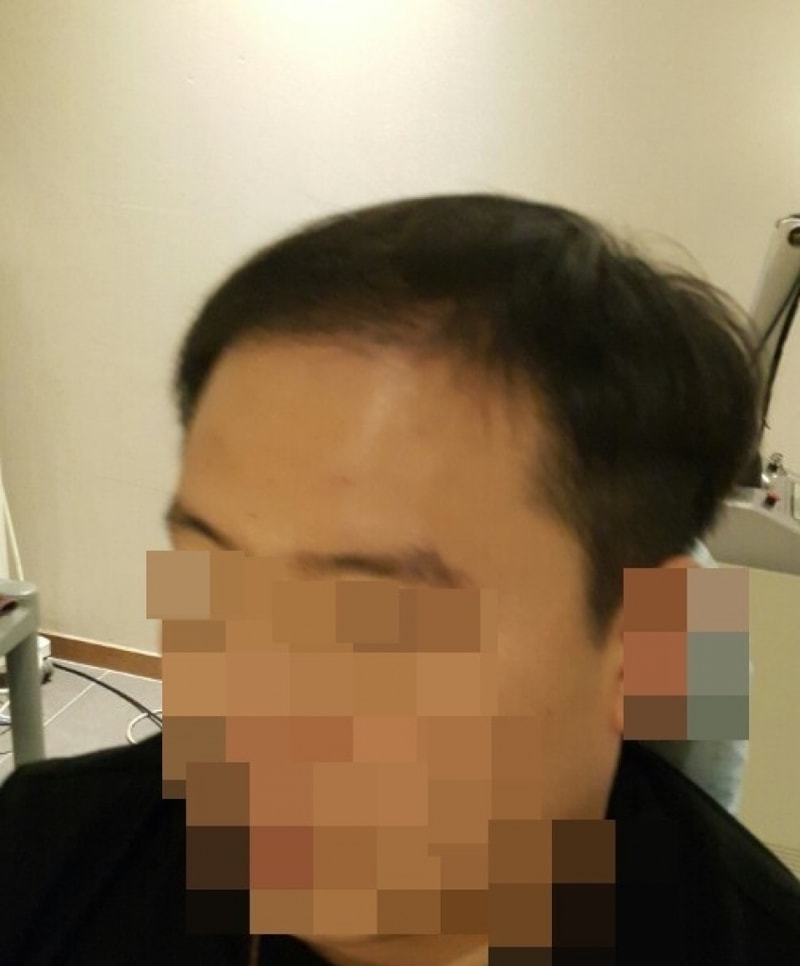5개월1.jpg