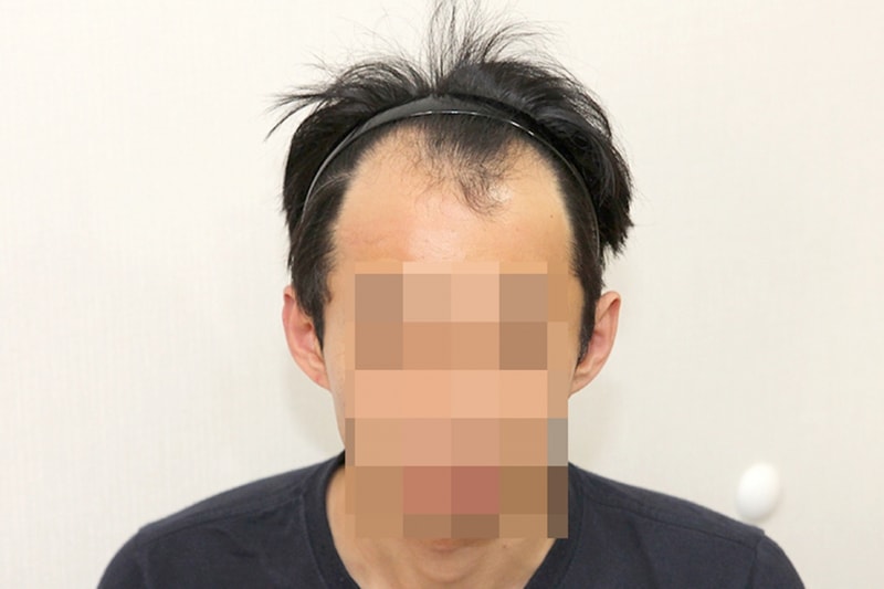 전1.jpg