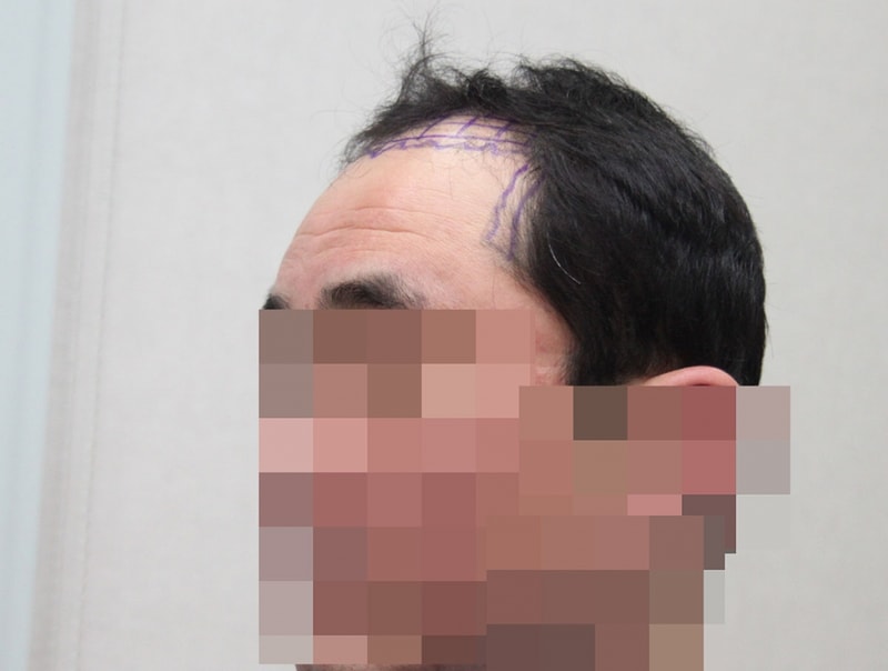 수술전_2.JPG