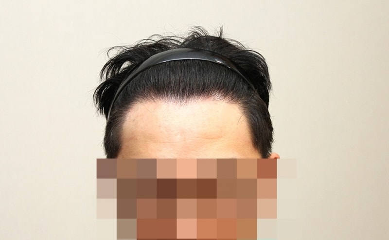 후1.JPG