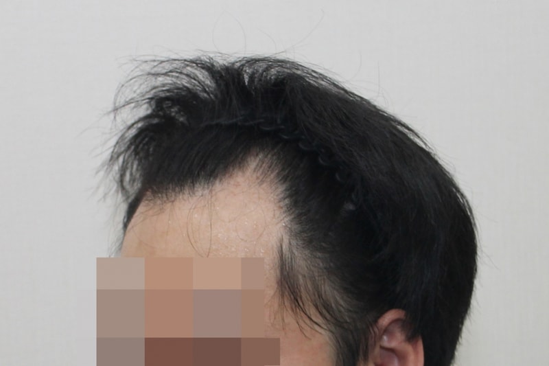 전2.jpg