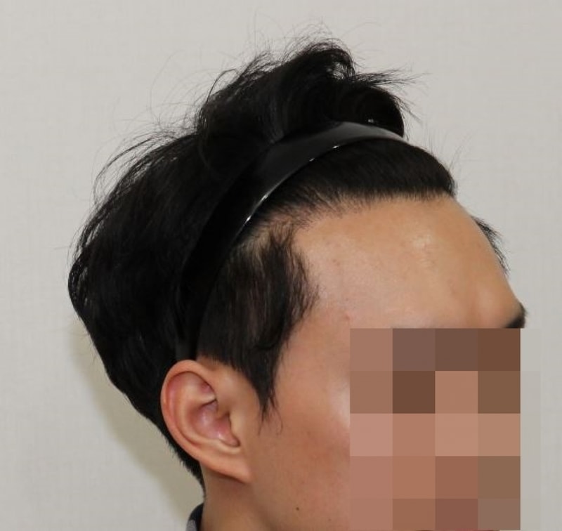 캡처.JPG