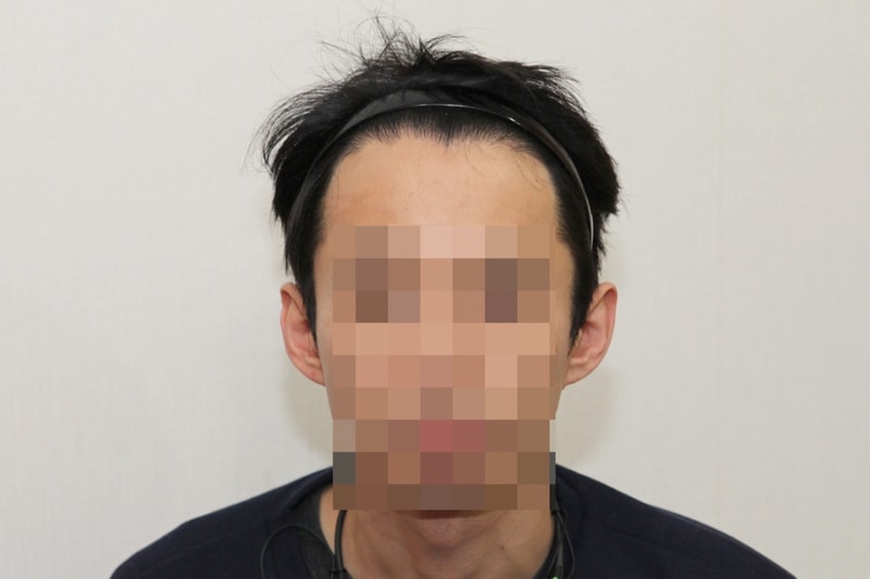 후1-2.jpg