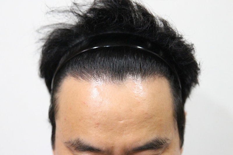 후2.jpg