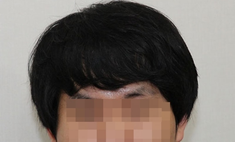 후.jpg