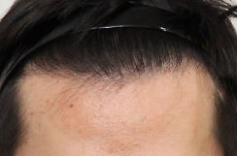 후.JPG