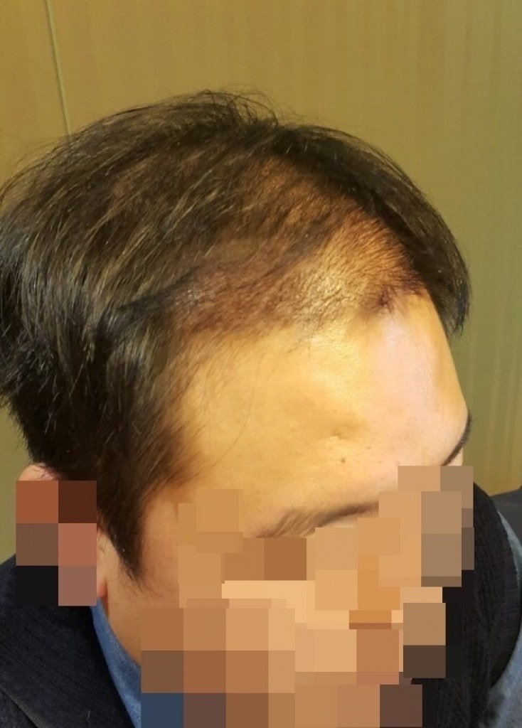 수술후3.jpg