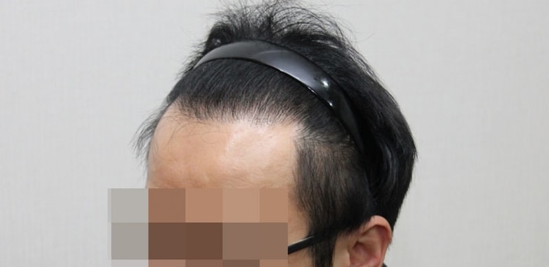 후2.jpg