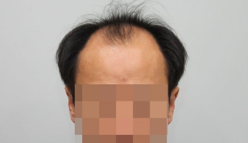 전1.jpg
