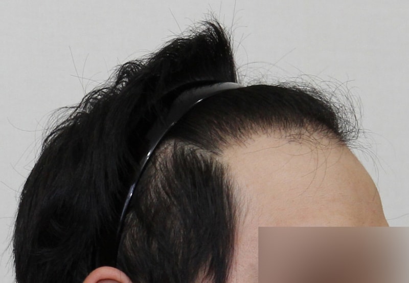 AFTER.JPG