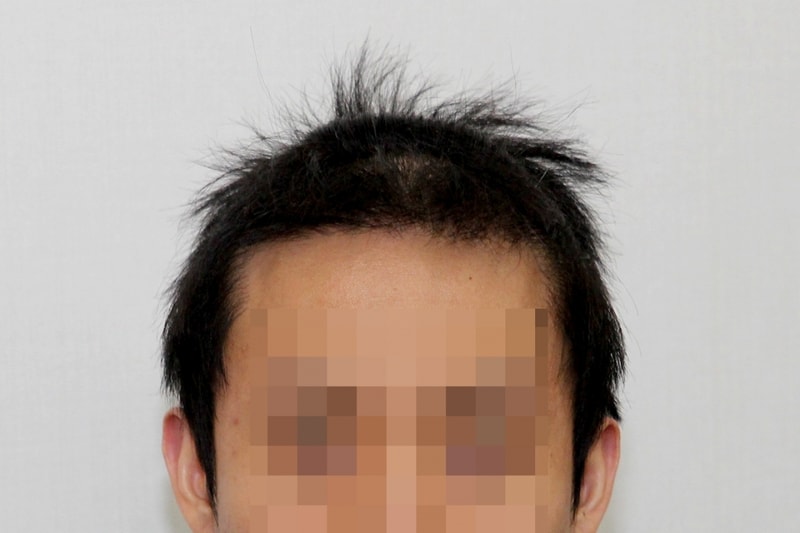 전.jpg