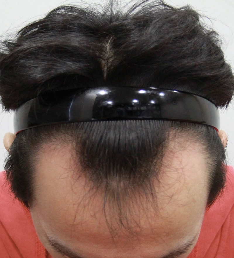 수술전.JPG