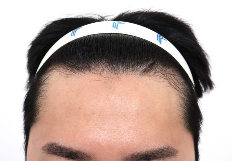포토후기 이미지
