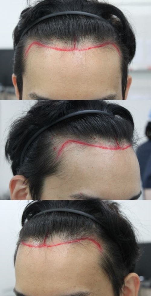 On the day of Busan Po Hair, it is two weeks, and it is a review of the dark period.