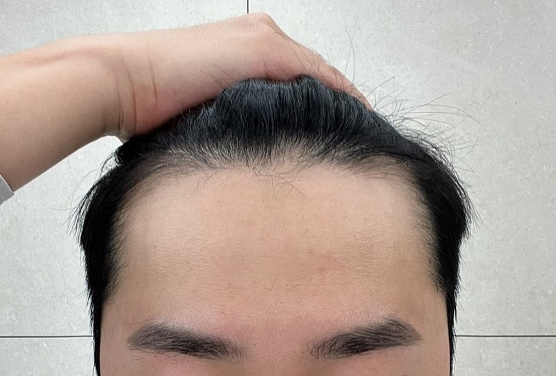 포토후기 이미지