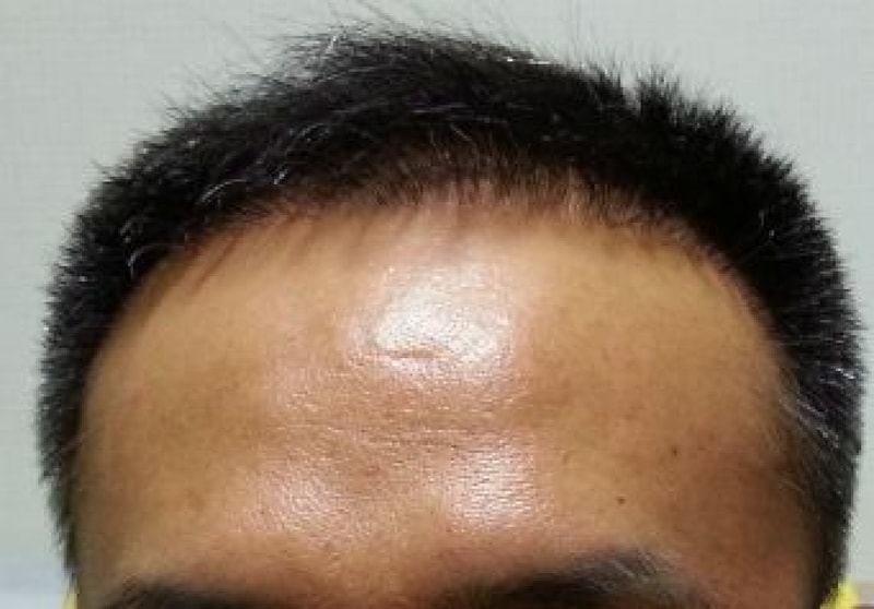 6개월차-정면.JPG