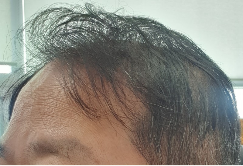 옆1.jpg