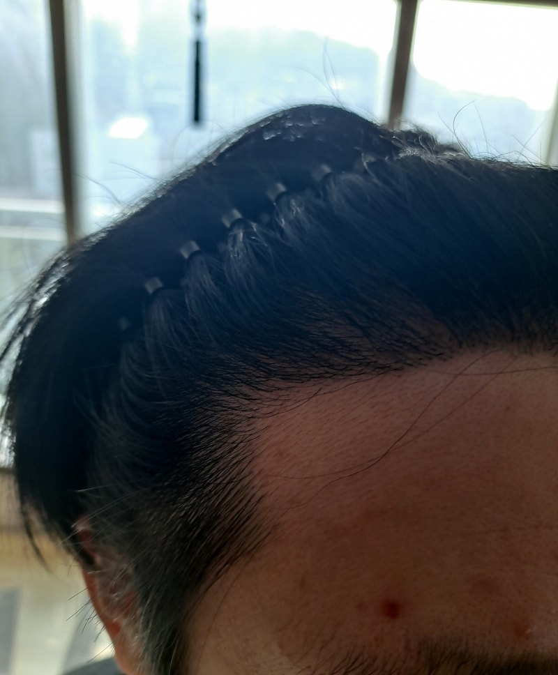 수술후2.jpg